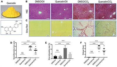 The Flavonoid Quercetin Ameliorates Liver Inflammation and Fibrosis by Regulating Hepatic Macrophages Activation and Polarization in Mice